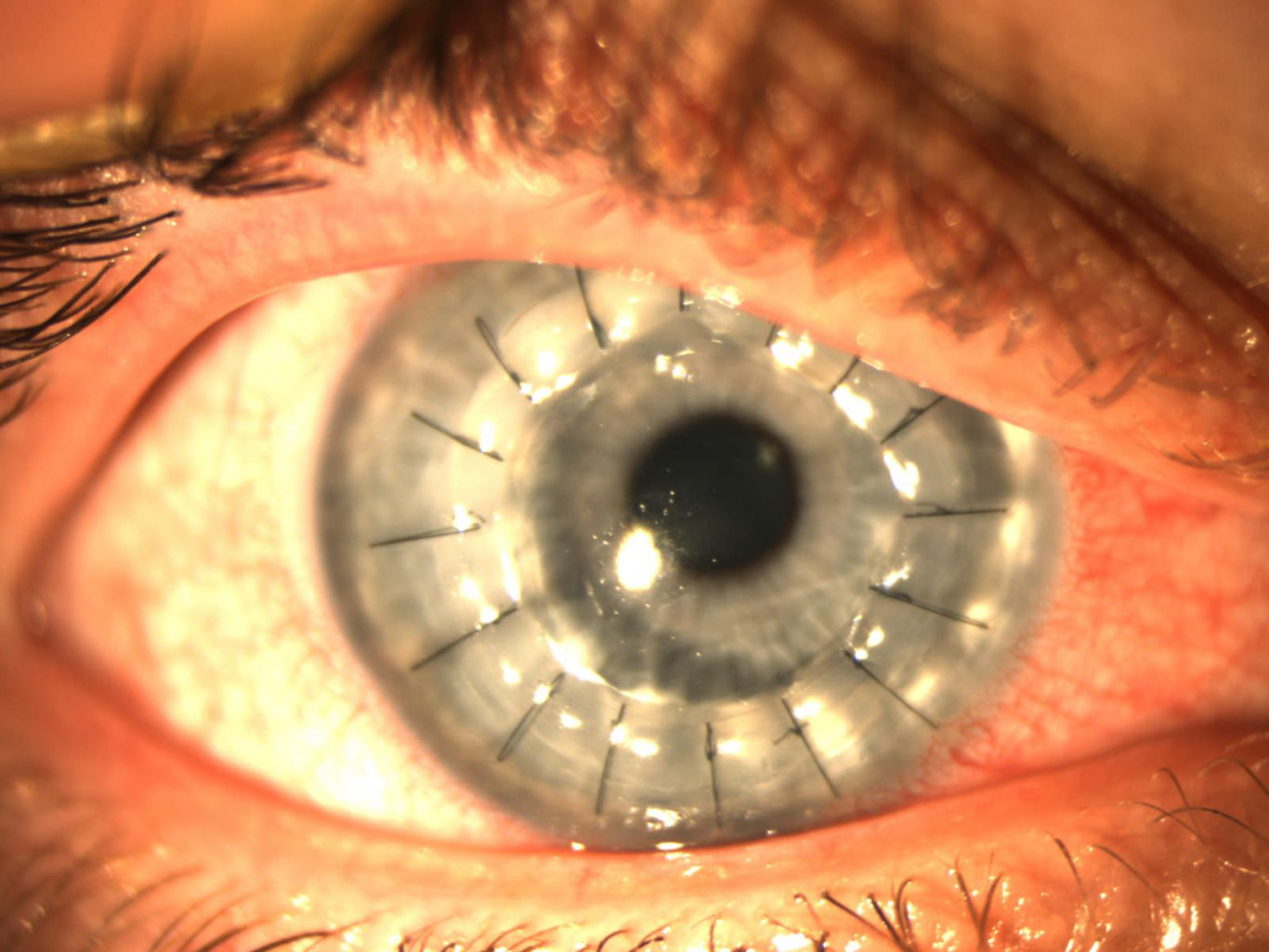 melyik látás jobb és melyik rosszabb mint a látásélesség növelése