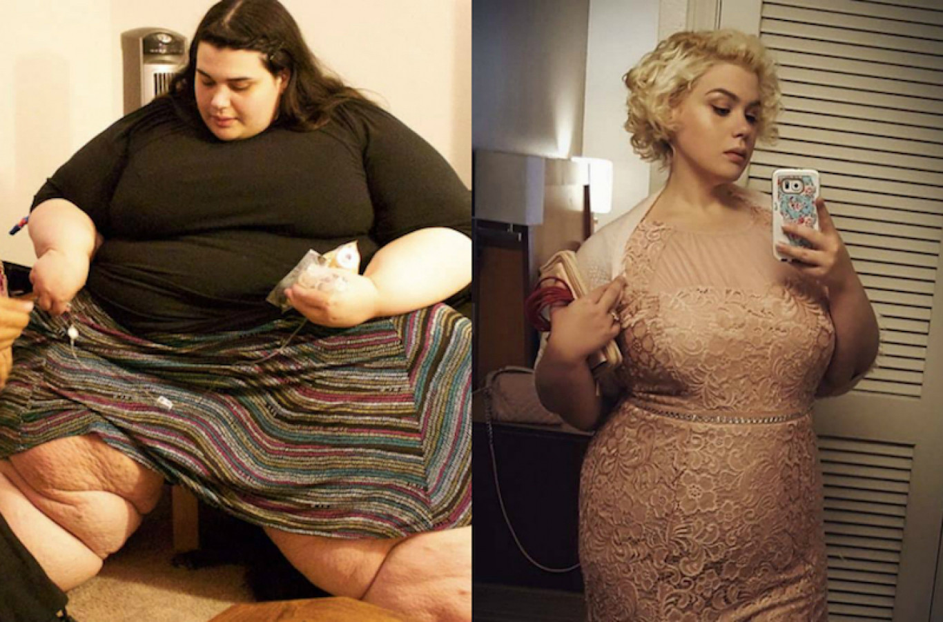 20 kg súlycsökkenés előtte és utána)